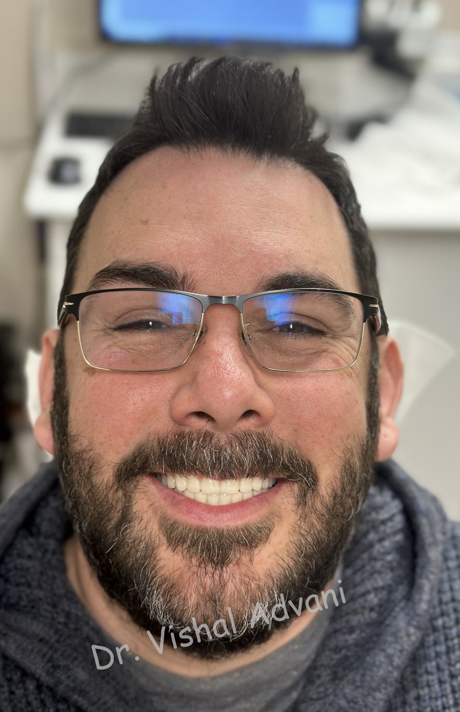 Patient with new full-arch dental implants smiling