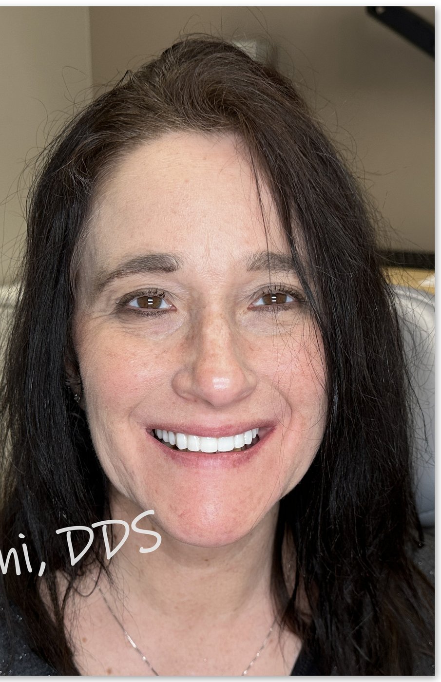 Patient smiling after dental implant treatment